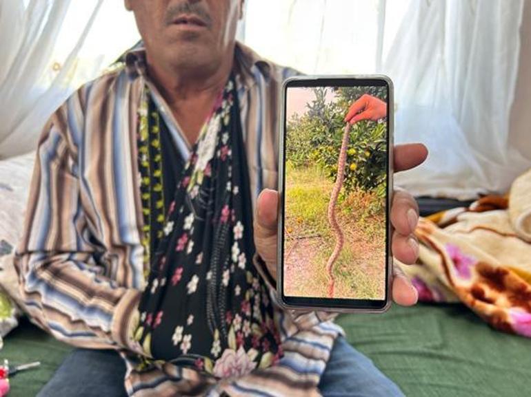 engerek isirdi eli bu hale geldi mermi sikilmis uzereydi 1 tQuzpS74