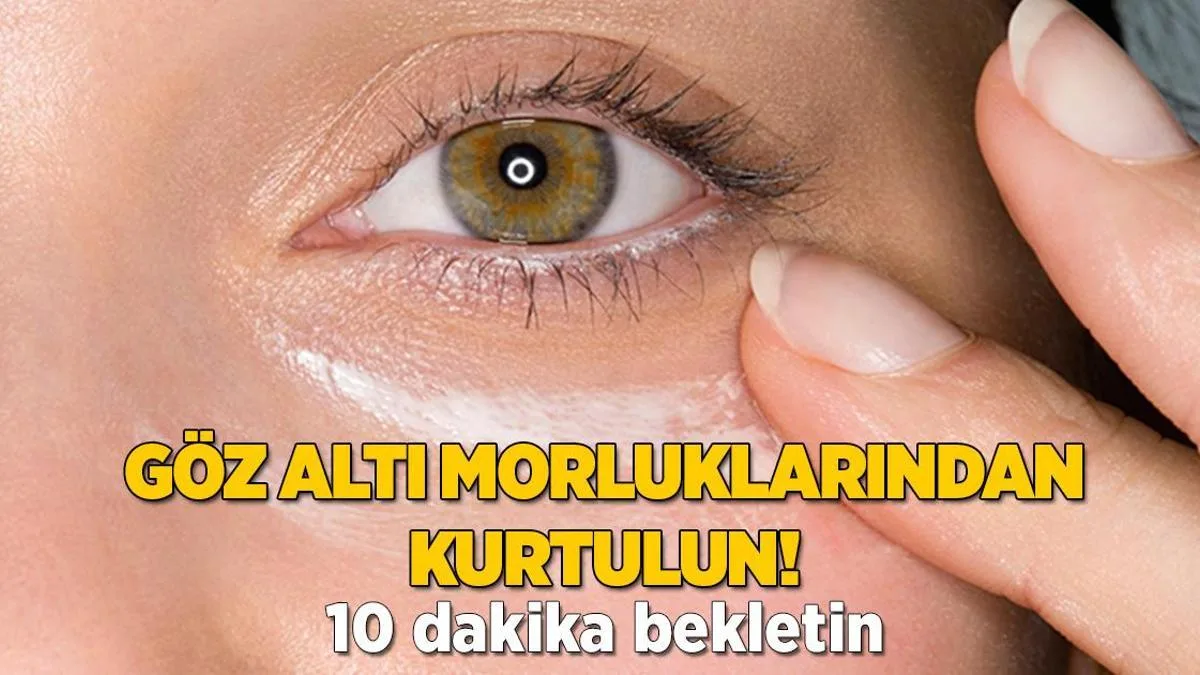 goz alti morluklarindan kurtulmanin yolu 1 dilimi bile aydinlatiyor 10 dakika k fi Fiiup1se jpg