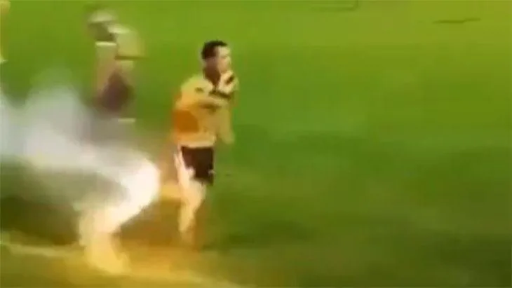 Belçika'da müthiş olay! Futbolcu 3 parmağını kaybetti 1 belcikada muthis olay futbolcu 3 parmagini kaybetti OQ2nypbs jpg