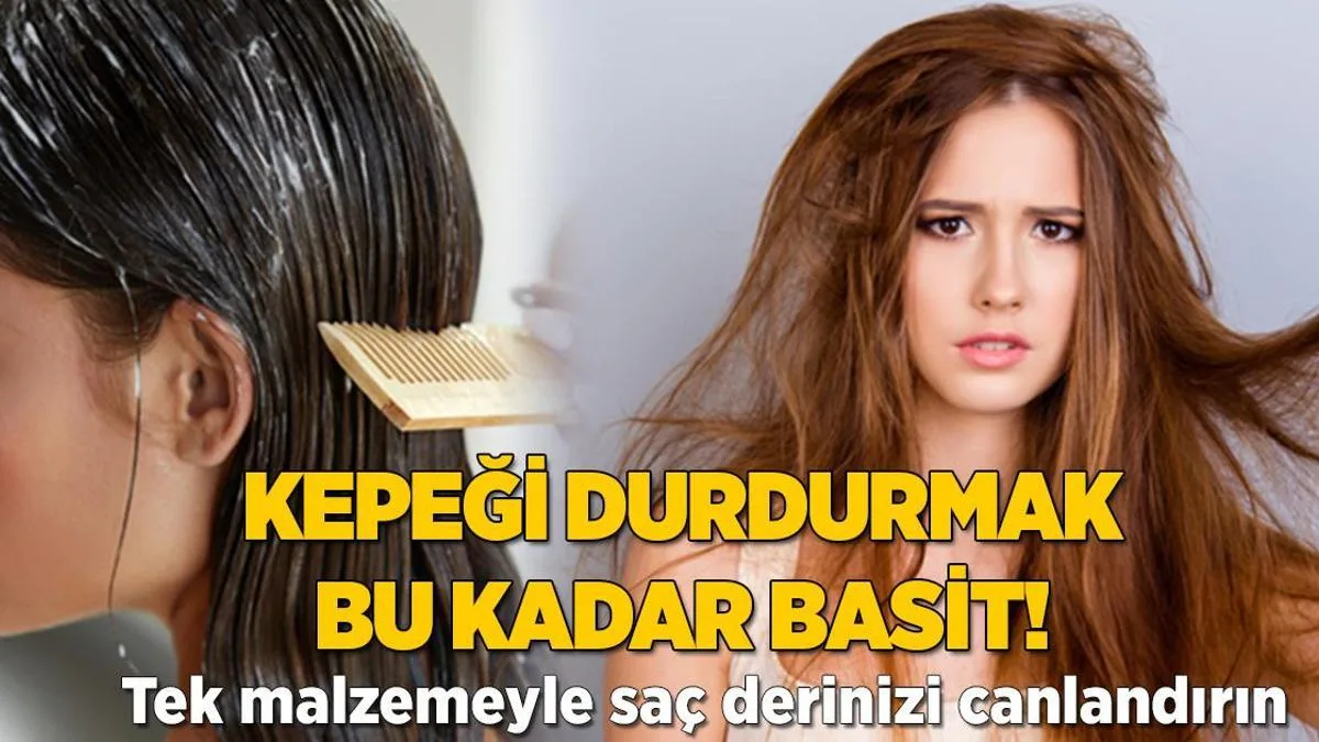 Kepeği durdurmak bu kadar basit! Tek materyalle saç derisini canlandırın 1 kepegi durdurmak bu kadar basit tek materyalle sac derisini canlandirin WtkzKlOj jpg