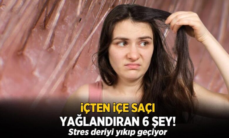 icten ice saci yaglandiran 6 sey stres sac tellerini yikip geciyor YJJuNlnv