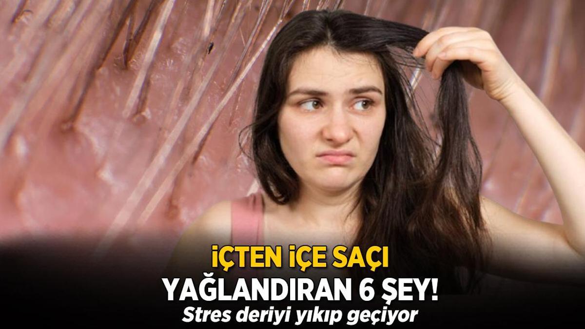 İçten içe saçı yağlandıran 6 şey! Stres saç tellerini yıkıp geçiyor