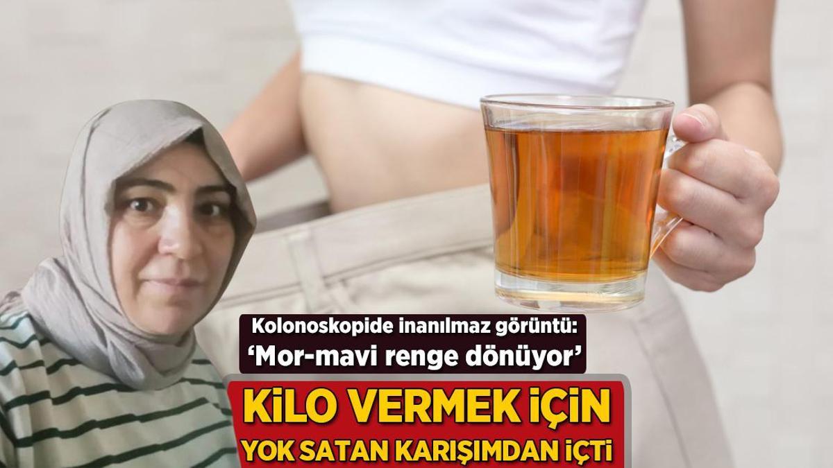 Kilo vermek için yok satan karışımdan içti! İnanılmaz görüntü: ‘Mor-mavi renge dönüyor’