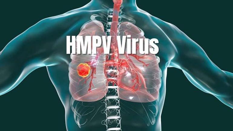 hmpv turkiyede goruldu mu yeni virus salginiyla ilgili aciklama geldi 1 Cg5iAelU