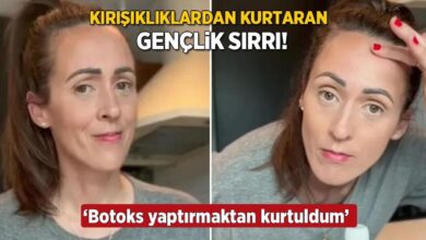 genclik pinariyla kirisiklik kalmadi 40 yasinda botoks yaptirmaktan kurtuldum Osp6KfbR