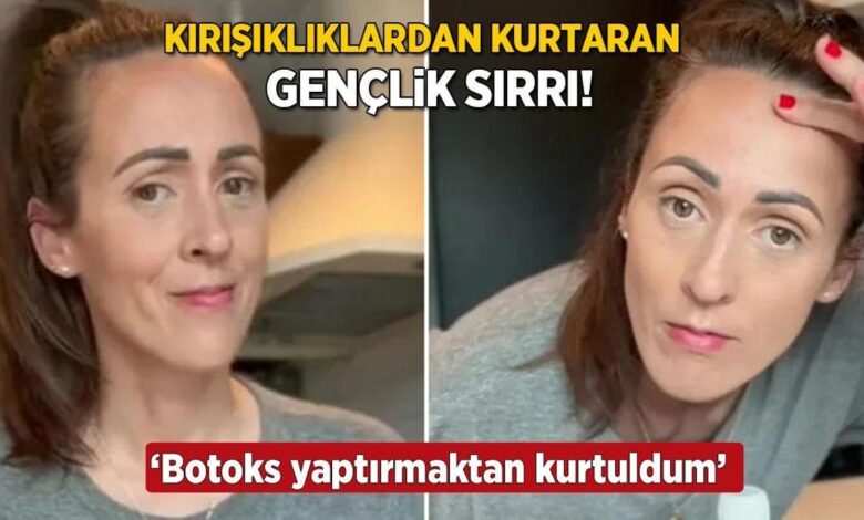 genclik pinariyla kirisiklik kalmadi 40 yasinda botoks yaptirmaktan kurtuldum Osp6KfbR