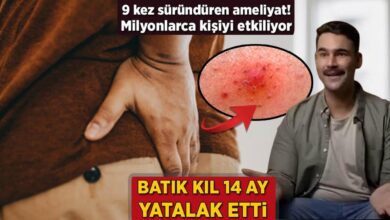 iceri batan kil 14 ay yatalak etti 9 defa surunduren ameliyat milyonlari etkiliyor LvMHJI69