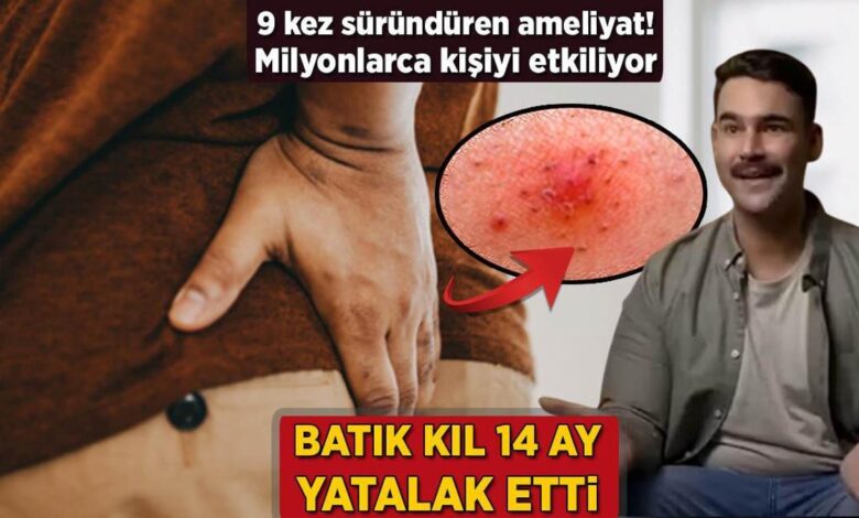 iceri batan kil 14 ay yatalak etti 9 defa surunduren ameliyat milyonlari etkiliyor LvMHJI69