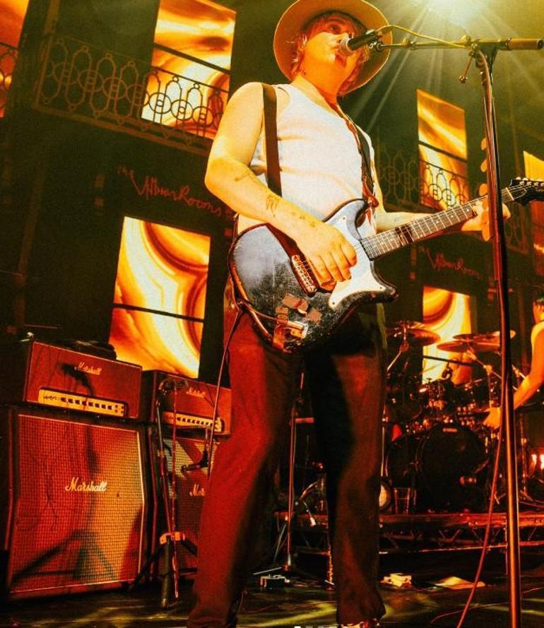 Rock yıldızından hayranlarını endişelendiren haber! Parmakları kesilebilir 3 rock yildizindan hayranlarini endiselendiren haber parmaklari kesilebilir 1 lLrURSUH