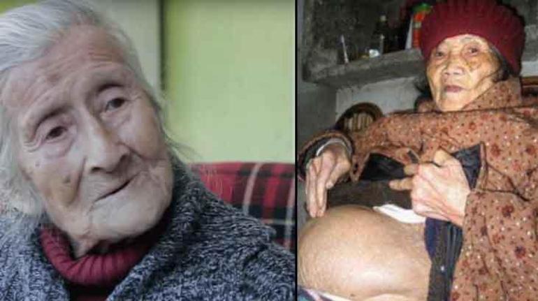 Benjamin Button kadar tuhaf, yıllarca fark etmedi! 60 yaşında doğan 'taş bebek' 2 benjamin button kadar tuhaf yillarca fark etmedi 60 yasinda dogan tas bebek 0 HzGTqy8t