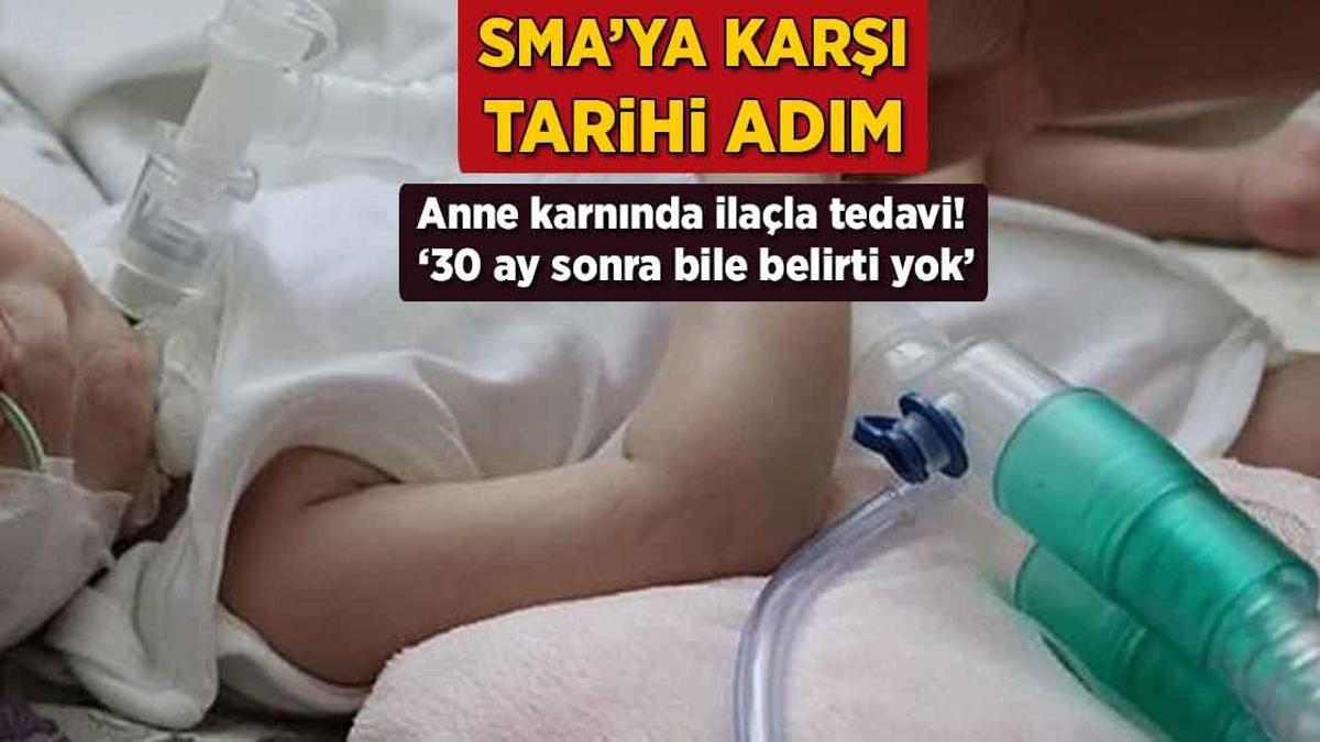 SMA’ya karşı tarihi adım! Anne karnında ilaçla tedavi: ’30 ay sonra bile belirti yok’
