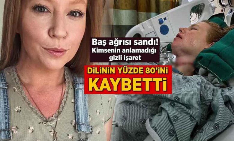 bas agrisi sandi lisaninin yuzde 80ini kaybetti kimsenin anlamadigi bilinmeyen isaret 3kdxMOy2