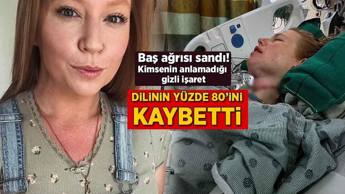 Baş ağrısı sandı, lisanının yüzde 80’ini kaybetti! Kimsenin anlamadığı bilinmeyen işaret