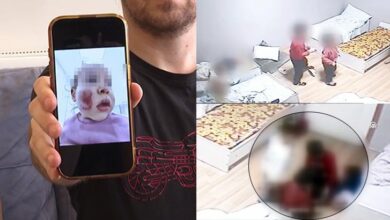 kreste dehset iki yasindaki bebek oteki cocuklar tarafindan dovuldu yuzu her yeri parcalanmis qYE873hA