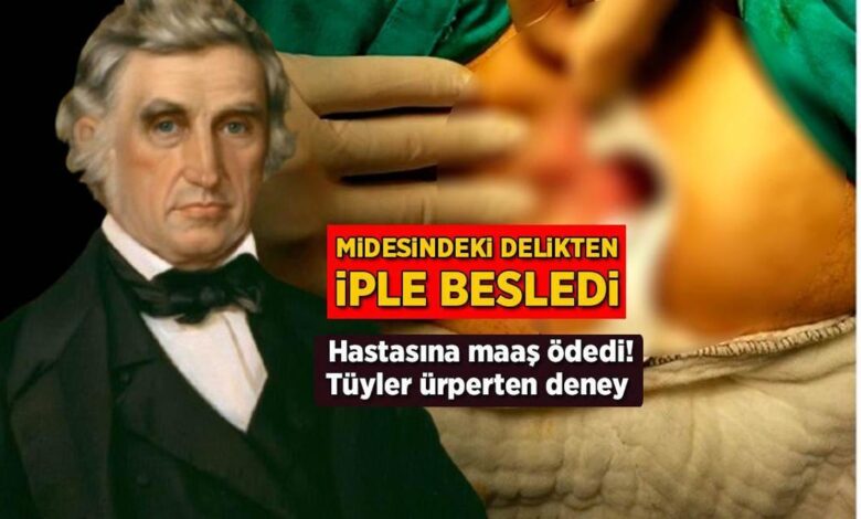 Midesindeki delikten iple besledi! Hastasına maaş ödedi, tüyler ürperten deney 1 midesindeki delikten iple besledi hastasina maas odedi tuyler urperten deney TTEENTqc