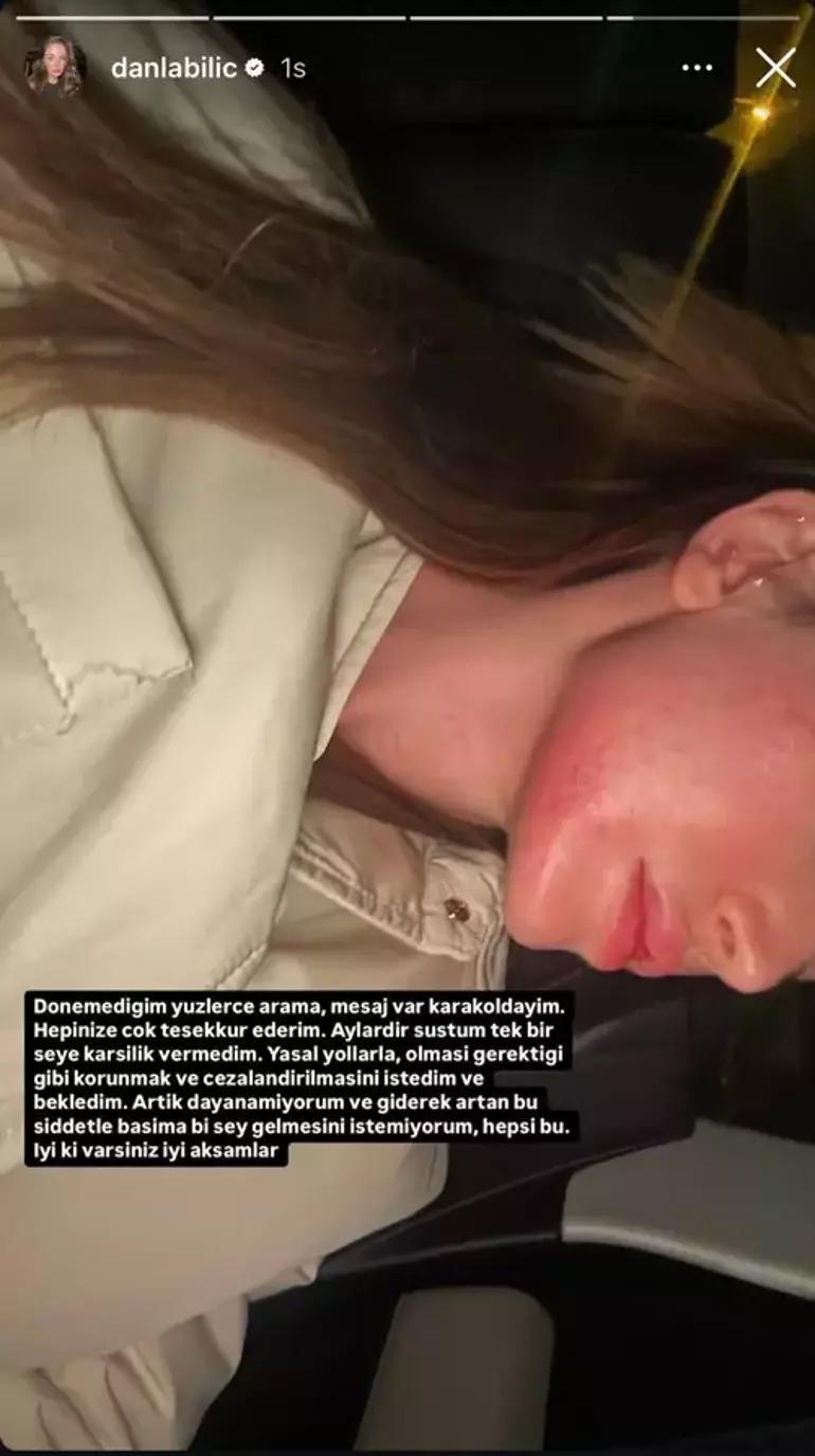 Son dakika: Danla Bilic'i darbeden eski sevgilisi Berk Çetin yakalandı! İşte birinci sözü 2 son dakika danla bilici darbeden eski sevgilisi berk cetin yakalandi iste birinci sozu 0 2tP5Eahy
