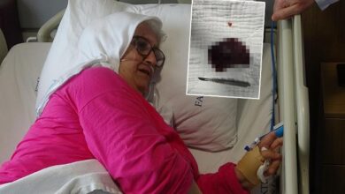 yuttugu kuruyemis akcigerini curuttu bir daha yemem qUn8ek64