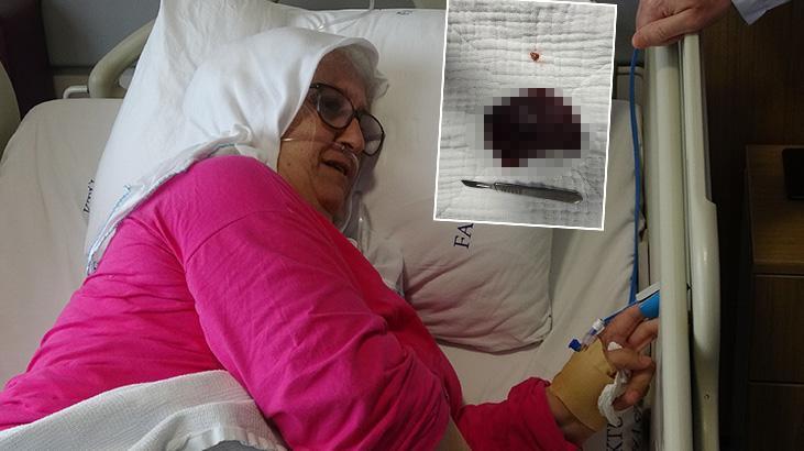 Yuttuğu kuruyemiş akciğerini çürüttü: Bir daha yemem 1 yuttugu kuruyemis akcigerini curuttu bir daha yemem qUn8ek64