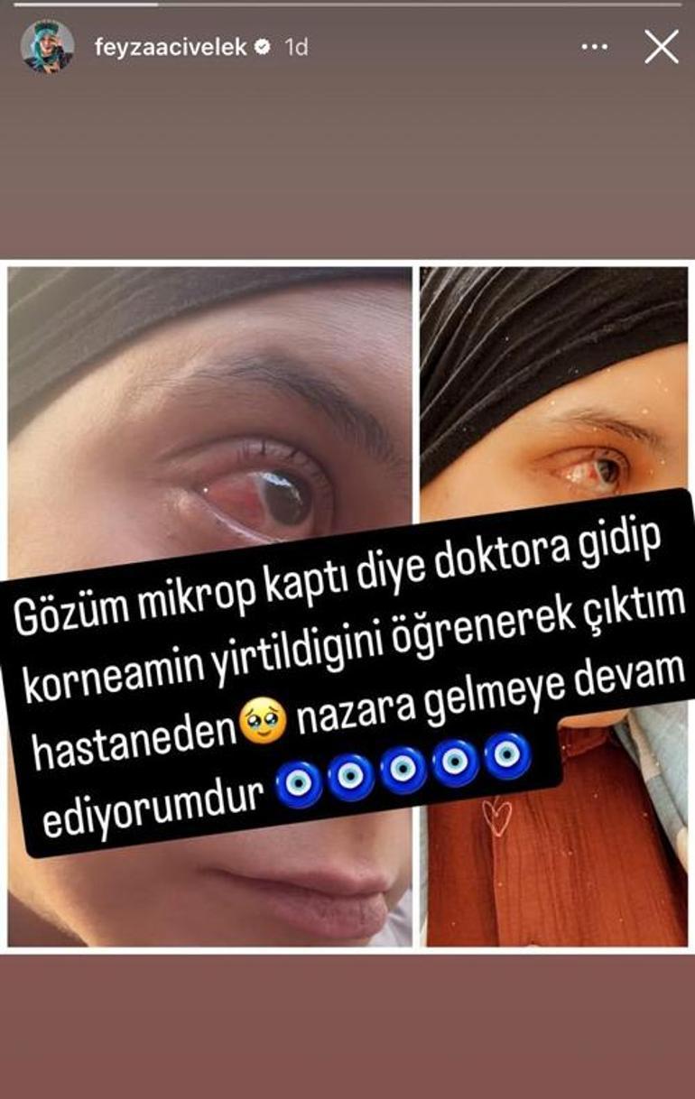 Feyza Civelek'in başına gelmeyen kalmadı! Kolundan sonra artık de gözü 2 feyza civelekin basina gelmeyen kalmadi kolundan sonra artik de gozu 0 NXpwSWOy