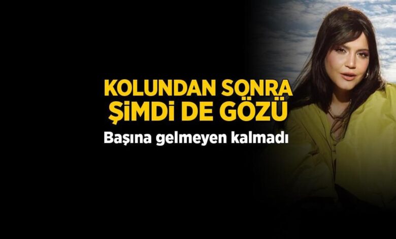 Feyza Civelek'in başına gelmeyen kalmadı! Kolundan sonra artık de gözü 1 feyza civelekin basina gelmeyen kalmadi kolundan sonra artik de gozu fJkzrZub
