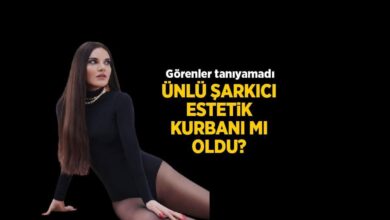 gorenler unlu muzikciyi taniyamadi goksel estetik kurbani mi oldu pqxWR7GB