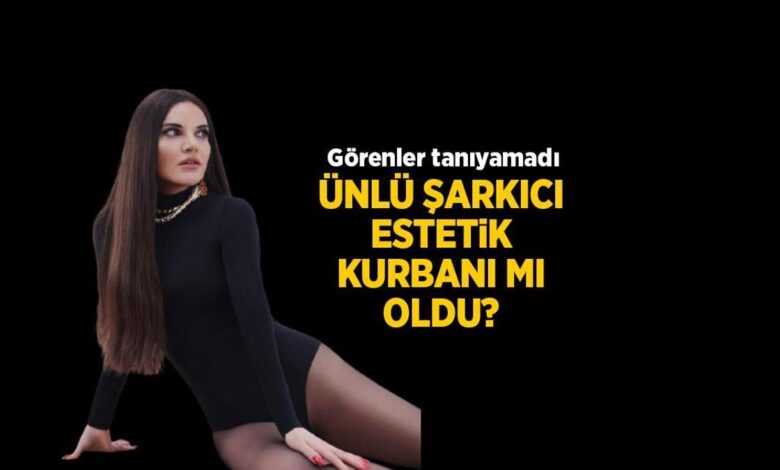 Görenler ünlü müzikçiyi tanıyamadı! Göksel estetik kurbanı mı oldu? 1 gorenler unlu muzikciyi taniyamadi goksel estetik kurbani mi oldu pqxWR7GB