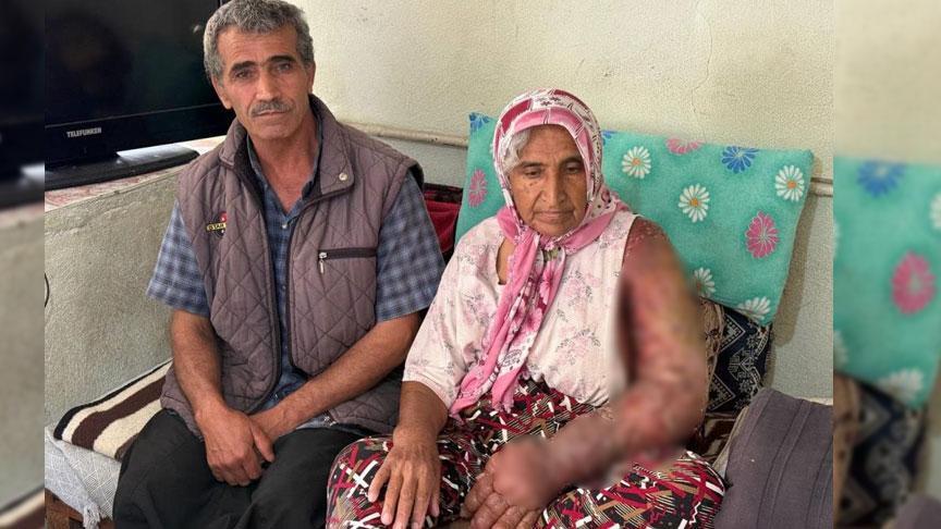 Her şey 8 yıl evvel başladı! Kolu şişti, bedenine kadar yayıldı 2 her sey 8 yil evvel basladi kolu sisti bedenine kadar yayildi 0 tAtnk4Oc