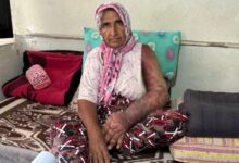 her sey 8 yil evvel basladi kolu sisti bedenine kadar yayildi nPgQGjsm