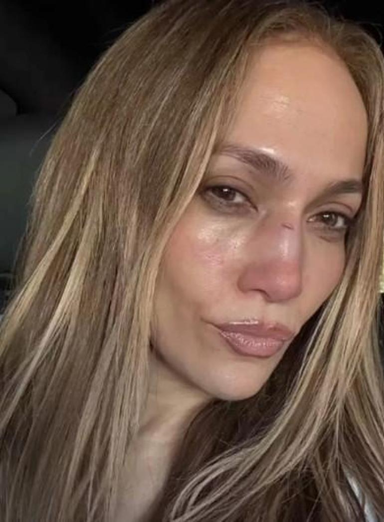 Jennifer Lopez sevenlerini korkuttu! Apar topar müdahale edildi 3 jennifer lopez sevenlerini korkuttu apar topar mudahale edildi 1 52p69kcG