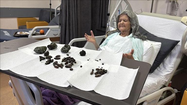 Karın ağrısı sandı, oysaki taşmış! Hurma ile zeytin tek hatalısı: 'Kimse yutmasın' 3 karin agrisi sandi oysaki tasmis hurma ile zeytin tek hatalisi kimse yutmasin 1 Y9YneZWz