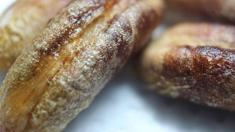 Karın ağrısı sandı, oysaki taşmış! Hurma ile zeytin tek hatalısı: 'Kimse yutmasın' 4 karin agrisi sandi oysaki tasmis hurma ile zeytin tek hatalisi kimse yutmasin 2 kLmYS926