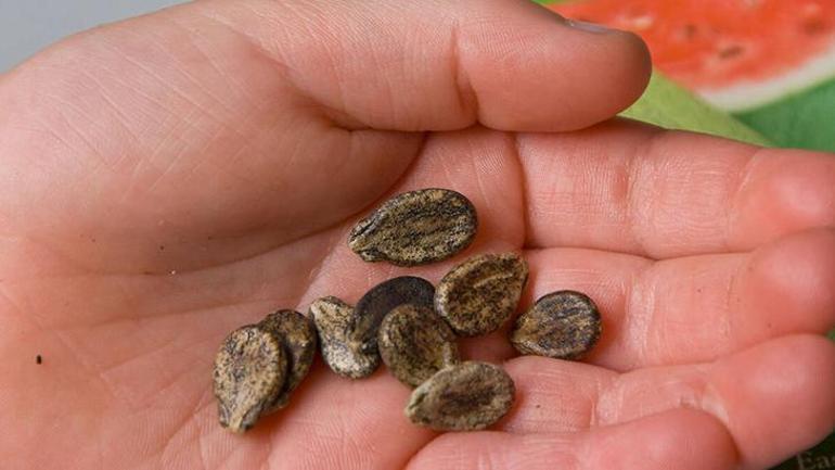 Karın ağrısı sandı, oysaki taşmış! Hurma ile zeytin tek hatalısı: 'Kimse yutmasın' 5 karin agrisi sandi oysaki tasmis hurma ile zeytin tek hatalisi kimse yutmasin 3 4yQlbmN2