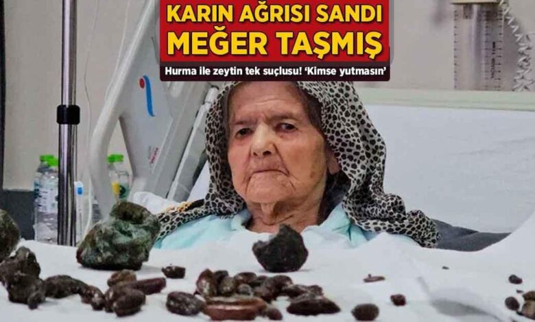 Karın ağrısı sandı, oysaki taşmış! Hurma ile zeytin tek hatalısı: 'Kimse yutmasın' 1 karin agrisi sandi oysaki tasmis hurma ile zeytin tek hatalisi kimse yutmasin 9Ghccfgk