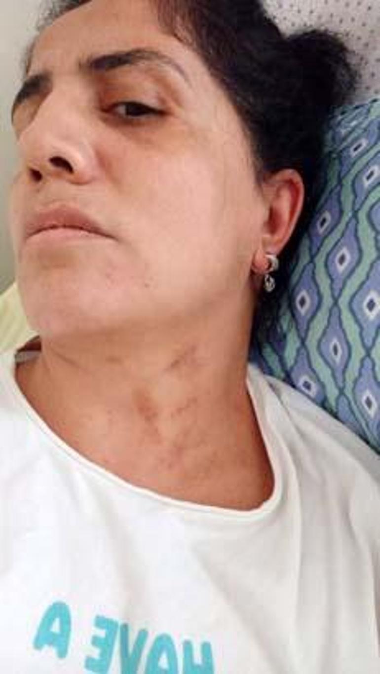 Zorla evlendirildi, hayatı kabusa döndü: Bunları hak edecek ne yaptım 2 zorla evlendirildi hayati kabusa dondu bunlari hak edecek ne yaptim 0 CO7NUKjF