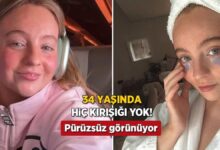 34 yasinda hic kirisikligi yok bir bant hayatini degistirdi botokssuz basardim WvWsA9dC