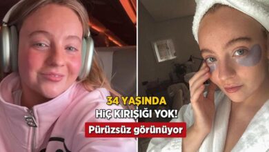 34 yasinda hic kirisikligi yok bir bant hayatini degistirdi botokssuz basardim WvWsA9dC