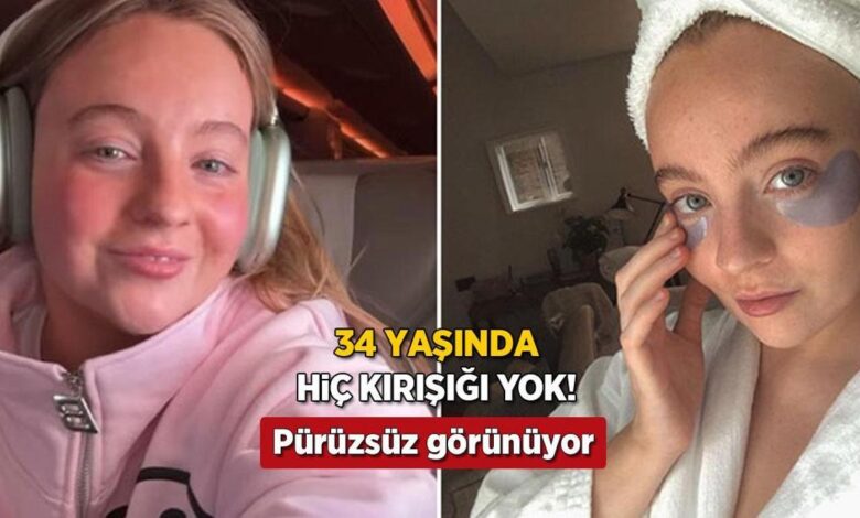 34 yasinda hic kirisikligi yok bir bant hayatini degistirdi botokssuz basardim WvWsA9dC