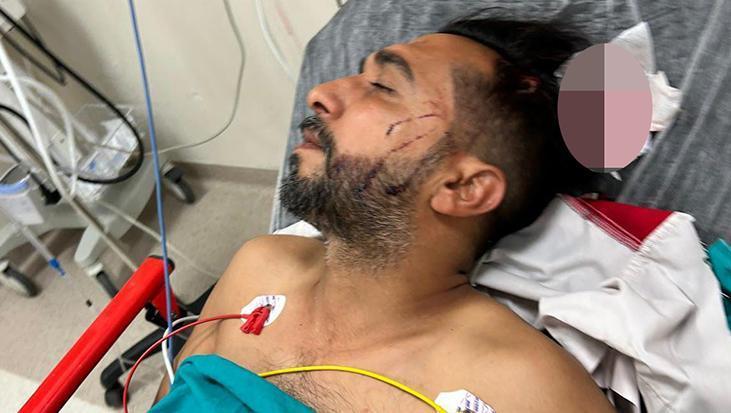 Adana'da döner ustasının başına çalıştığı sırada yorgun mermi isabet etti 1 adanada doner ustasinin basina calistigi sirada yorgun mermi isabet etti 4p2ZNPv4
