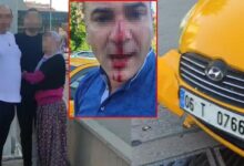kaza sonrasi dehset baba ogul obur surucuyu darbetti qBwsGBNR