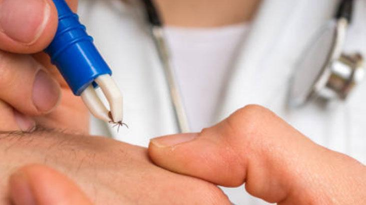 Keneler bu kan kümesine bayılıyor! Uzmanlar uyardı: 'Görmezden gelmeyin' 3 keneler bu kan kumesine bayiliyor uzmanlar uyardi gormezden gelmeyin 1 tQeB1C7I