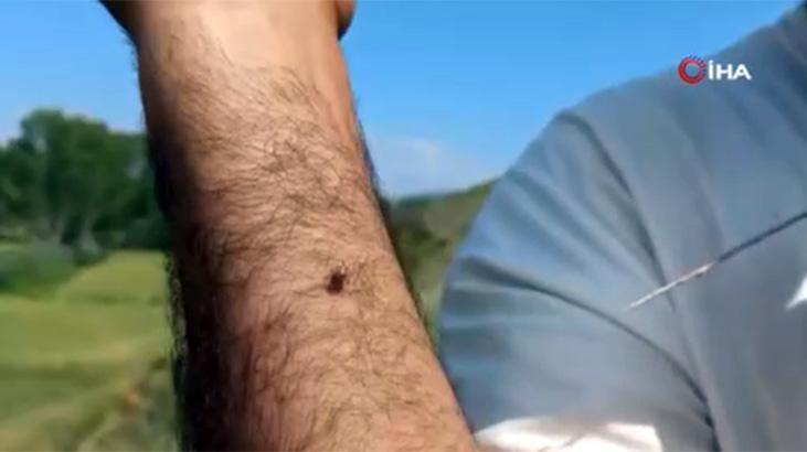 Kentte ürperten görüntü! Keneler adeta kovaladı: Radarına girince kaçamıyorsun 1 kentte urperten goruntu keneler adeta kovaladi radarina girince kacamiyorsun EdDvj3St