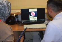 nefes borusuna seker ambalaji kacti 10 aylik bebek vefattan dondu ACLJawlf