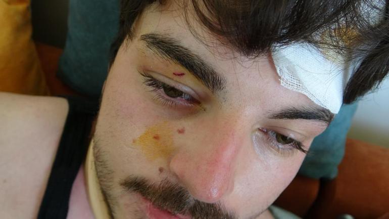 Oyuncu Mehmet Akif Akdeniz trafikteki dehşeti anlattı! 'Her yerim yara içindeydi' 3 oyuncu mehmet akif akdeniz trafikteki dehseti anlatti her yerim yara icindeydi 1