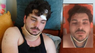 oyuncu mehmet akif akdeniz trafikteki dehseti anlatti her yerim yara icindeydi d5rESNUZ