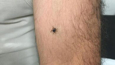 panik buyuyor bir ilcede daha kene olayi goruldu 9GlKvYeh