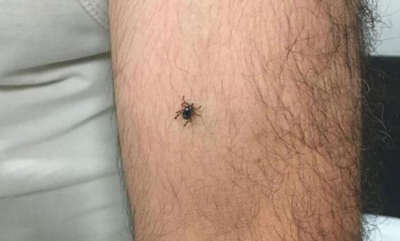 Panik büyüyor! Bir ilçede daha kene olayı görüldü 1 panik buyuyor bir ilcede daha kene olayi goruldu 9GlKvYeh