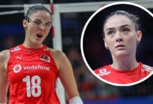 zehra gunes esirgeyici gozluk takti gozundeki sislik dikkat cekti 4UXyf3XA
