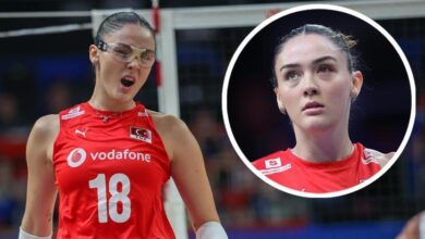zehra gunes esirgeyici gozluk takti gozundeki sislik dikkat cekti 4UXyf3XA