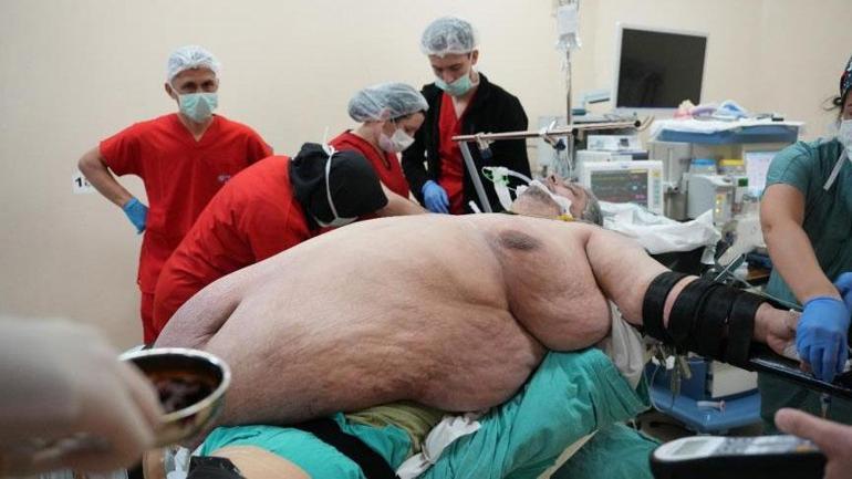 310 kiloya ulaştı! “Ölmek için dua ettim” dedi, yıllar sonra birinci adım 2 310 kiloya ulasti olmek icin dua ettim dedi yillar sonra birinci adim 0 sa35cnEJ