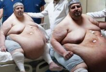 310 kiloya ulasti olmek icin dua ettim dedi yillar sonra birinci adim MY86xw1E